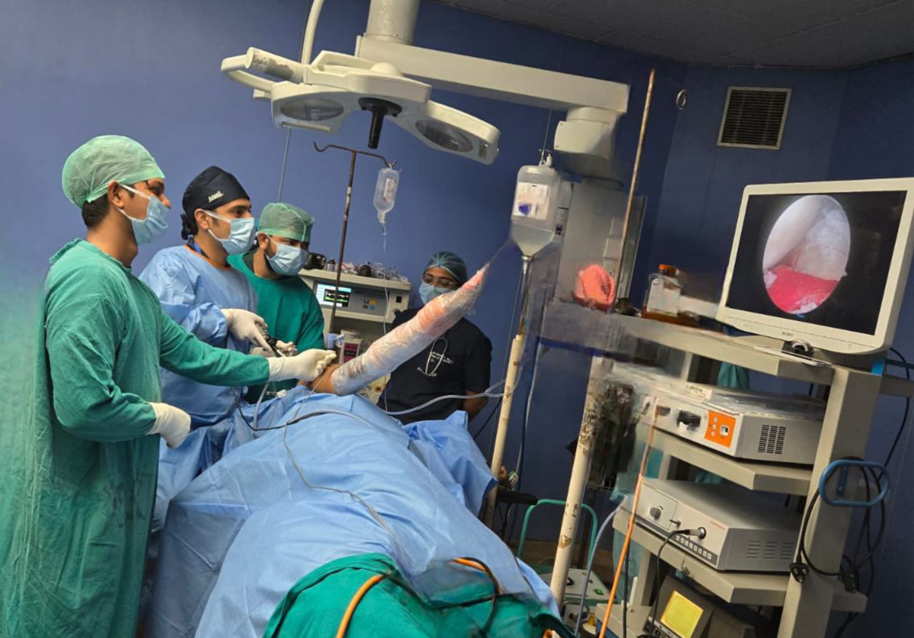 Agra News:एस.एन. में हुई सफल एडवांस्ड कंधा सर्जरी मरीजों के लिए नई उम्मीद बनी आधुनिक आर्थ्रोस्कोपी तकनीक